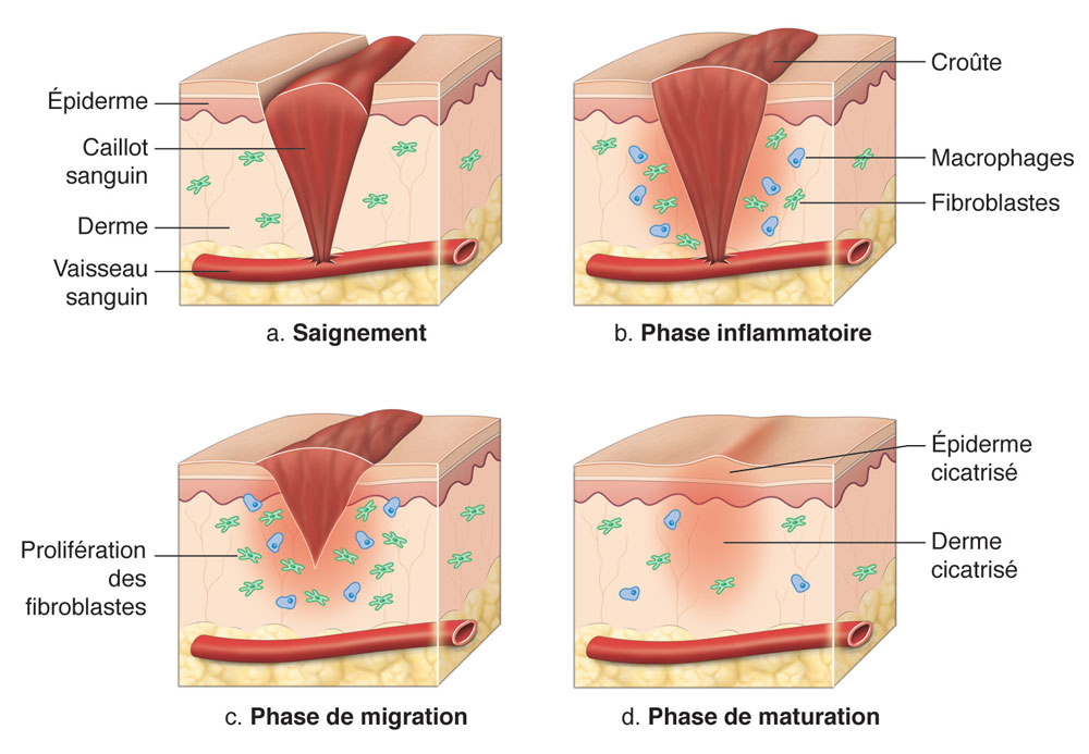 phase de cicatrisationG