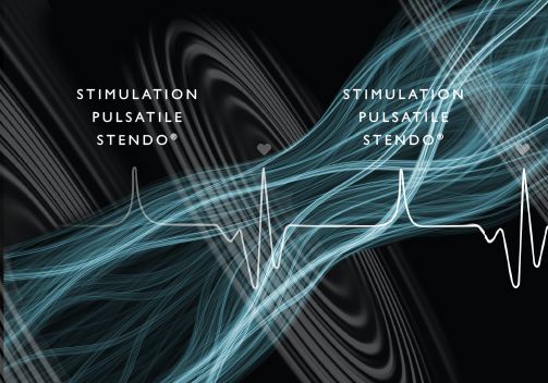 stimulation pulsative stendo